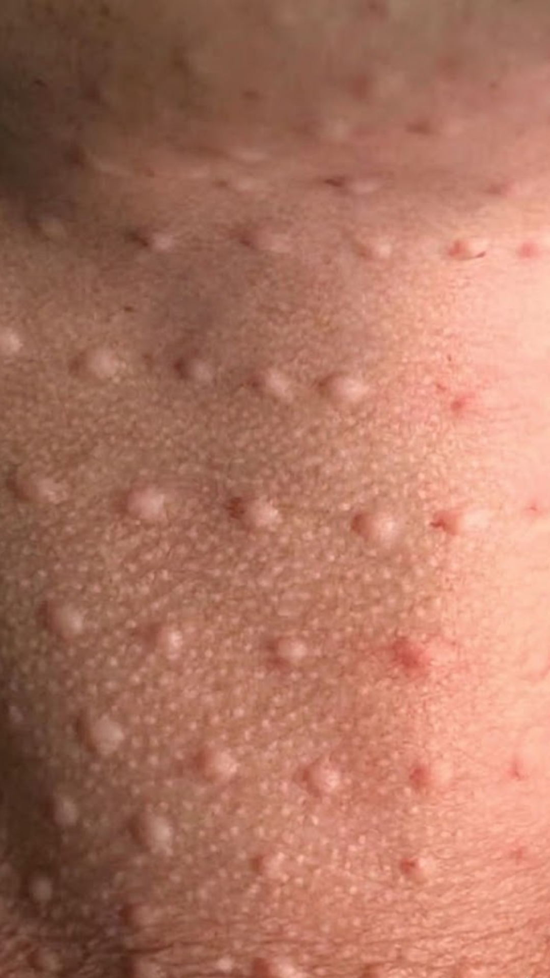 Regenere Skin